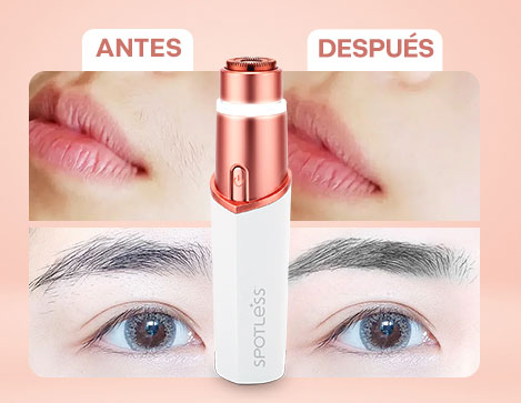 Imagen que muestra Spotless 